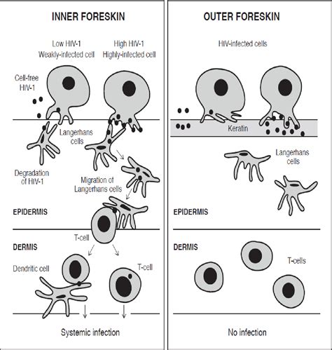 Infected Circumcision Symptoms