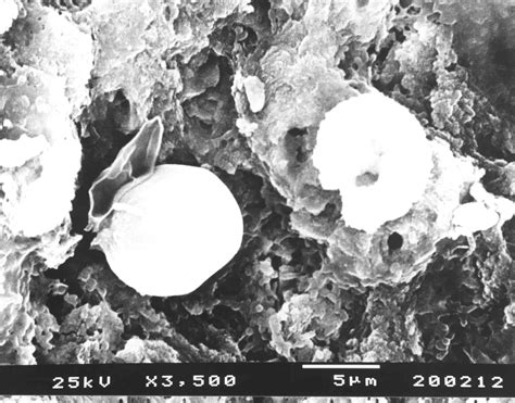 Effects Of Eryag Laser Irradiation On Dental Hard Tissues And All Ceramic Materials Sem