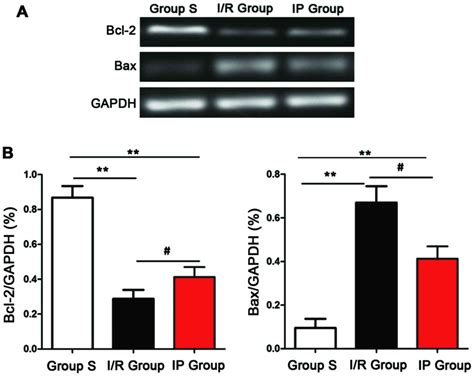 The Protective Effects Of Ischemic Preconditioning On Rats With Renal