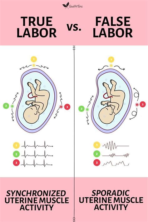 Key Differences True Labor Vs False Labor False Labor Pregnancy