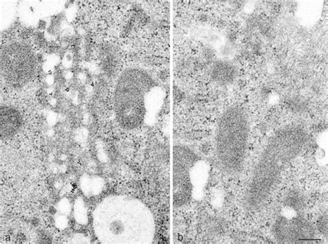 Em In Situ Hybridization Of Huh Cells Harboring A Subgenomic Hcv