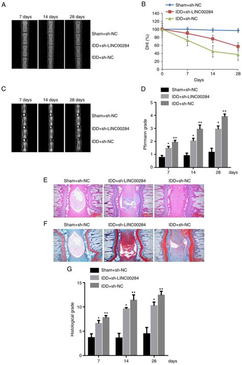 Lncrna Linc00284 Promotes Nucleus Pulposus Cell Proliferation And Ecm