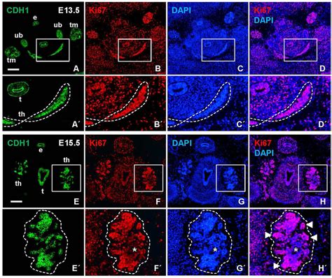 Mucin 1 Muc1 Expression Associated With Premature Differentiation