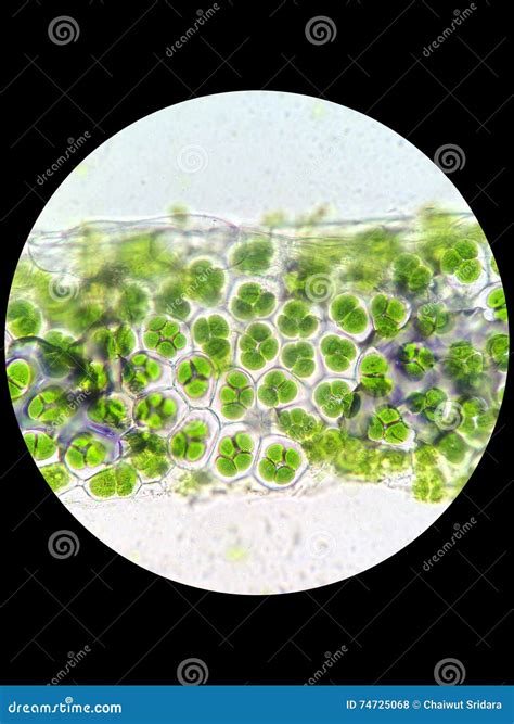 Plant Cell With Chloroplast Under Microscope Stock Photo ...