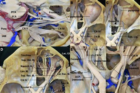 Superior Orbital Fissure Nerves