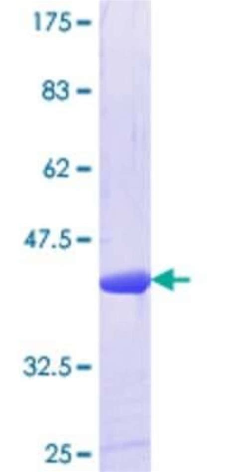 Novus Biologicals Recombinant Human Alpha Mannosidase A Gst N Term