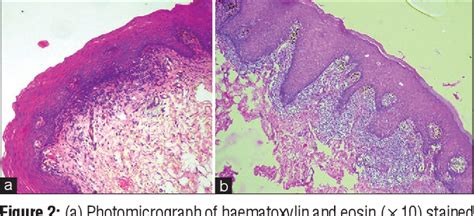 Figure 2 From A Comparison Of Proliferative Capacity Of Reticular And