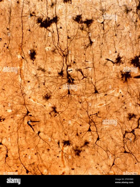 Light Micrograph Of Pyramidal Neurons Of The Cerebral Cortex Stained