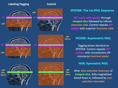 PASL Questions And Answers In MRI