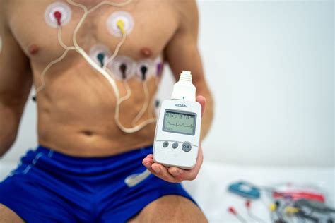 Holter EKG A Poliklinika Lumbalis