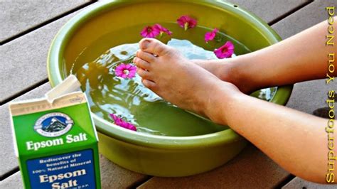 Home Remedies For Swollen Feet 10 Natural Remedies For Swollen Feet