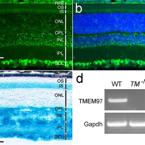 Retinal Morphology And Ergs Of Tmem97−− Mice A Semi Thin Retinal