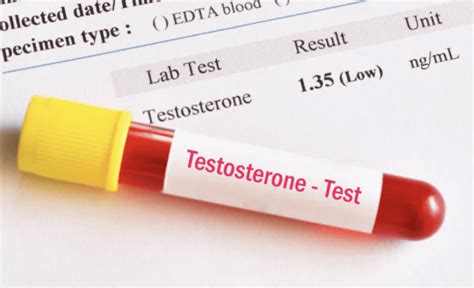 Is It Safe To Do Testosterone Replacement Therapy Trt Or Buy