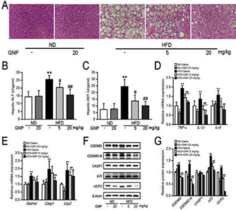 Genipin Reverses Hfd Induced Liver Damage And Inhibits Ucp2 Mediated