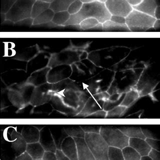 Representative Confocal Scanning Laser Micrographs Illus Trating ZO 1