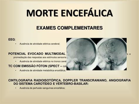 PPT MORTE ENCEFÁLICA e DOAÇÃO DE ÓRGÃOS PowerPoint Presentation ID