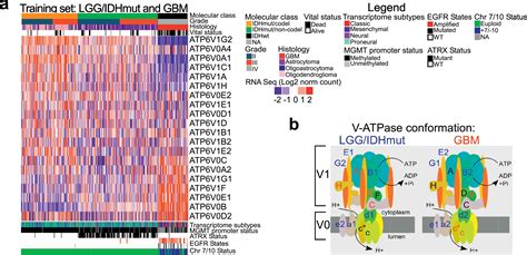 Specific V Atpase Expression Sub Classifies Idhwt Lower Grade Gliomas