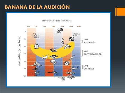 Acumetria Audiometria Logoaudiometria Impedanciometria Dr Edgar Ivan Sandoval