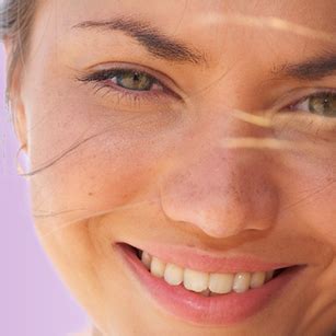 BBL Fotofacial | BBL Photorejuvenation Sydney | Infinity