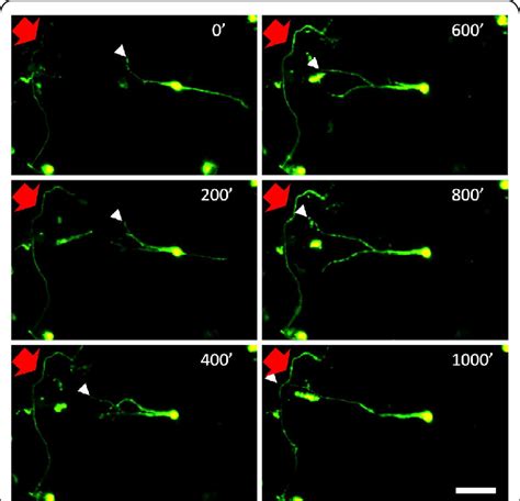 A Time Lapse Image Series Of An Egfp Transformed Sensory Neuron In 3d