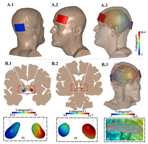 New Paper Intracranial Voltage Recording During Transcranial Direct