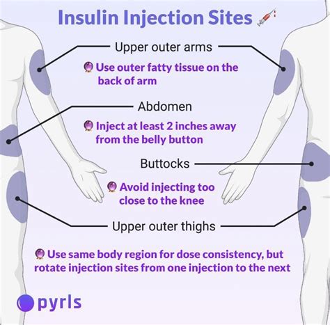 Insulin Injection Sites : r/coolguides