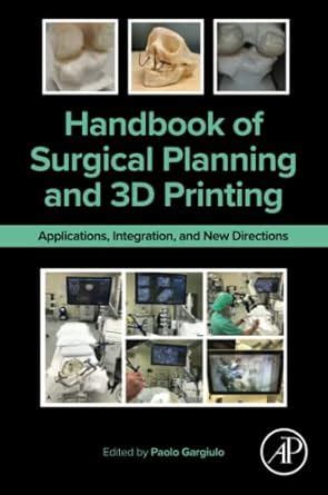 Handbook Of Surgical Planning And D Printing Applications