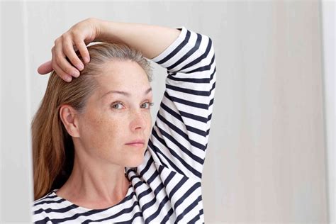 Understanding Premature Gray Hair Causes And Prevention Tips Fresh Life