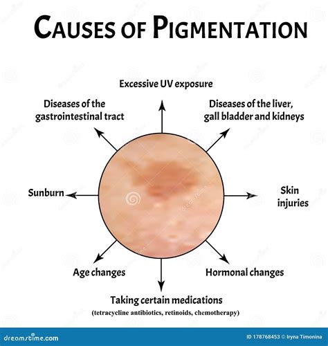 Les Causes De La Pigmentation De La Peau Taches Sombres Sur La Peau