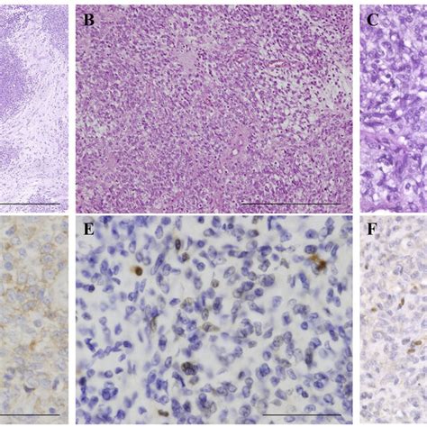 Histology And Immunohistochemical Staining Of The Myoepithelial