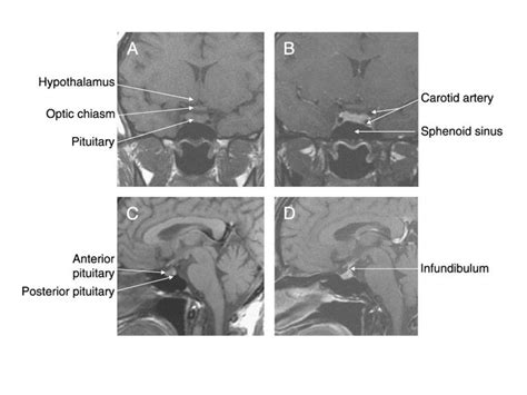 Pituitary Hypothalmus And Autonomics For The Rite Ppt Download