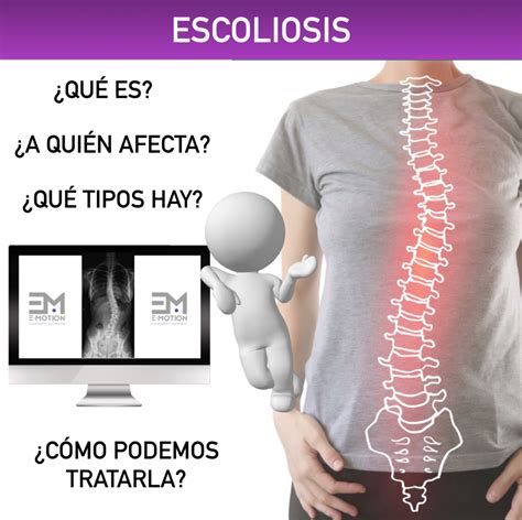 Escoliosis Emotion Training