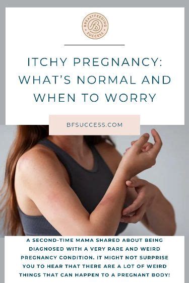 Itchy Pregnancy Whats Normal And When To Worry Pregnancy Prenatal