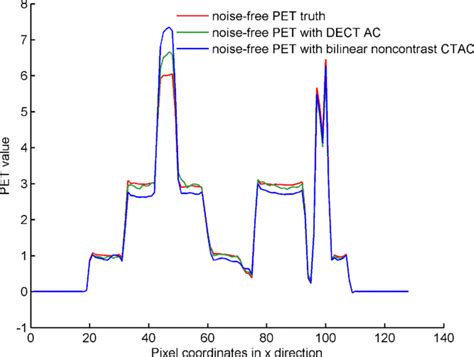 Profile Comparison Of The Reconstructed Noise Free Pet Images Osem