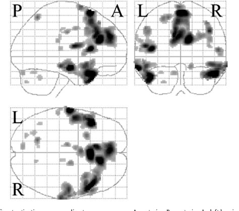 Anterior Prefrontal Cortex Activities During The Inhibition Of