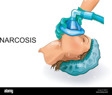 Vector Illustration Of Anesthetic Mask The Use Of Mask Anesthesia