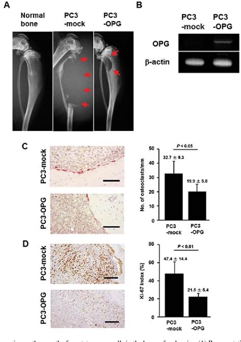 Figure 2 From Induction Of Retinol Binding Protein 4 And Placenta