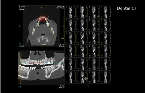 Neuviz In En Neusoft Medical Latinoam Rica