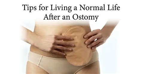 Tips For Living A Normal Life After An Ostomy Personally Delivered Blog