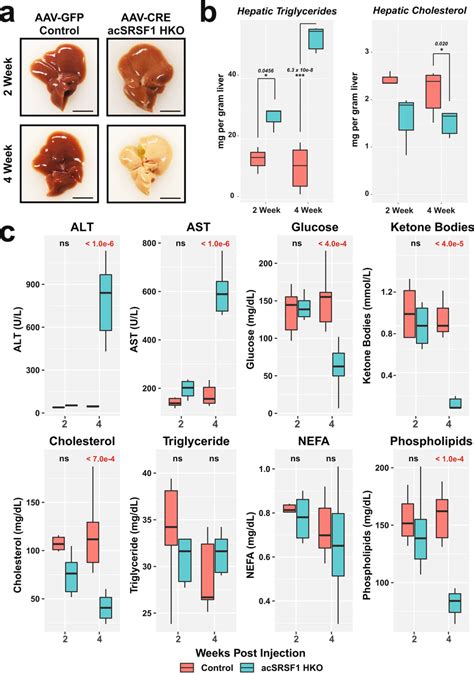 Acute SRSF1 HKO Mice Develop Hepatic Steatosis And Liver Damage A