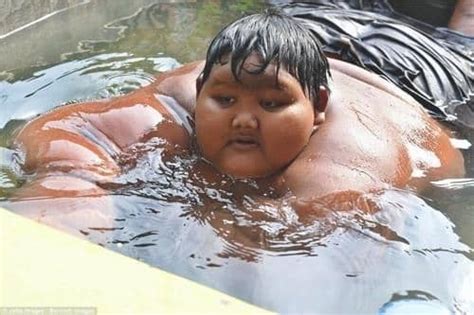 El niño Más Gordo del Mundo Niño Indonesio de 10 Años Pesa 192kg