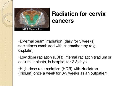 Radiation For Cervix Cancer