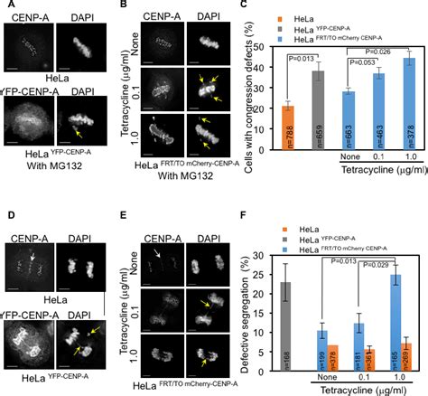 Figure 2 From Mislocalization Of Centromeric Histone H3 Variant CENP A