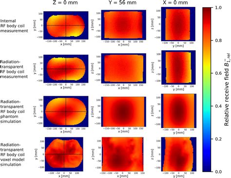 An Essentially Radiationtransparent Body Coil Integrated With A