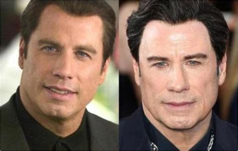 male celebrities with lip fillers - Unparalleled Memoir Picture Archive