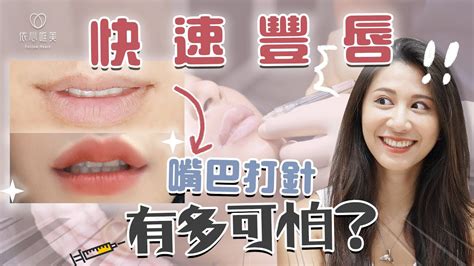 玻尿酸豐唇分享！嘴上打針有多痛？多久自然？效果如何｜依心唯美 謝東穎醫師 Youtube