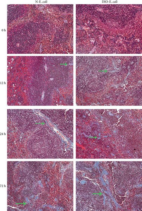 Histological Images Of Spleen Tissue Masson Masson Trichrome