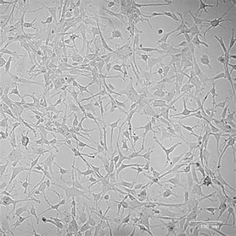 Human Dopaminergic Neuronal Precursor Cells - Neural Cell System