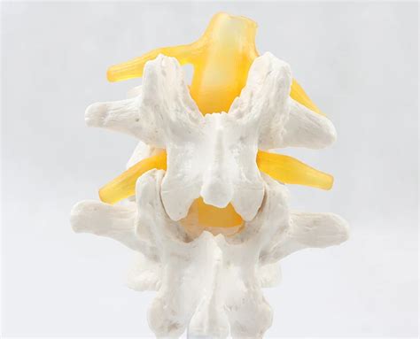 ZLF Scientific Human Anatomy Lumbar Model And Diseased Intervertebral