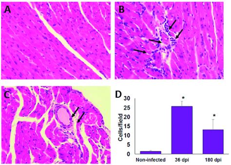 Infiltrated Cells In Cardiac Tissue Of Balb C Mice Infected With T